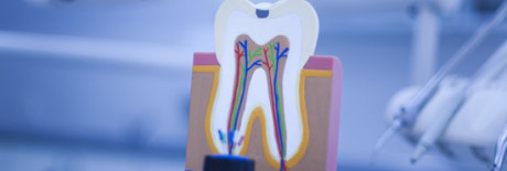 Endodoncja - Leczenie kanałowe powtórne mikroskopowe